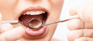 Gum Disease Could Mean Earlier Death in Post-Menopause 1