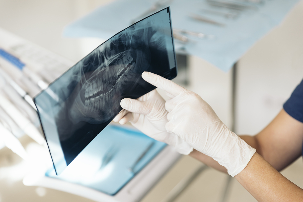 What Is In-Office Dentistry? 1 dental xray