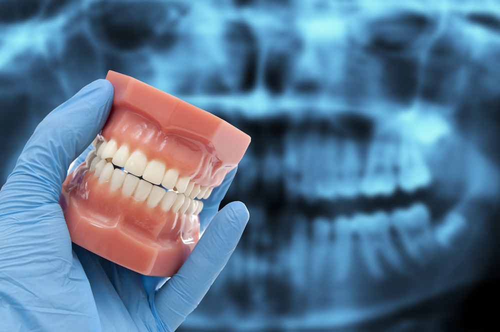 What Is a T-scan Machine? 1 Dentist holding model of teeth